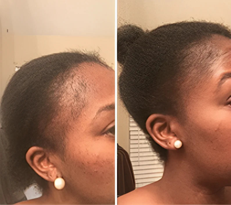No more hiding my hairline - Jasmine T.