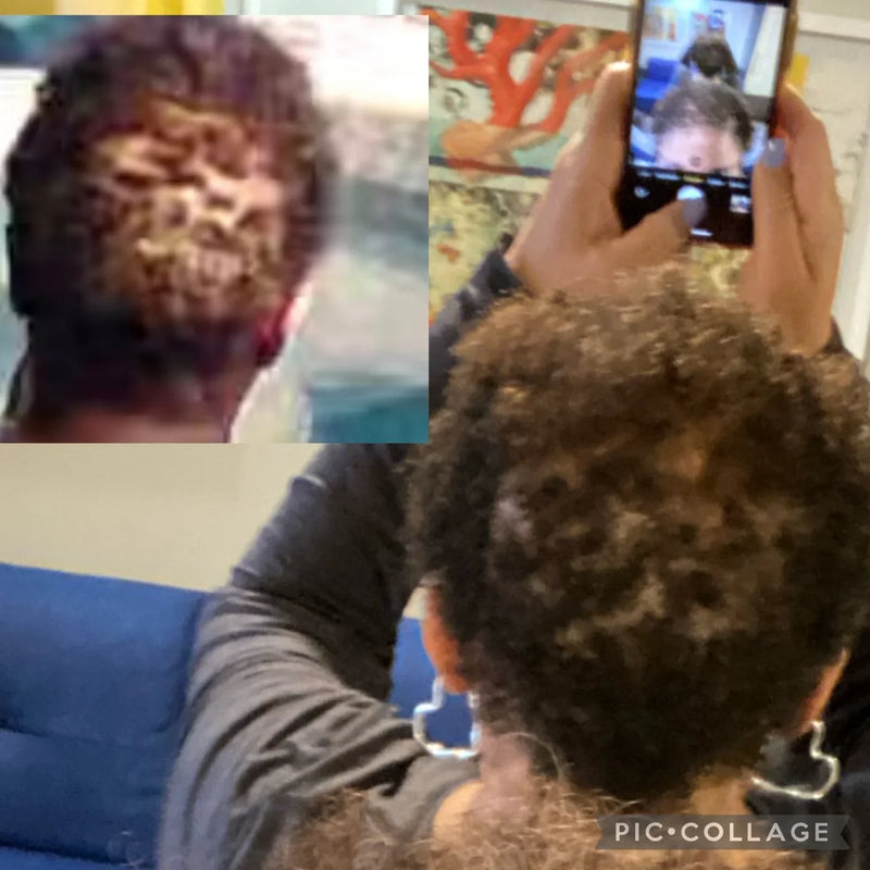 Stopped the hair loss - Monique K.