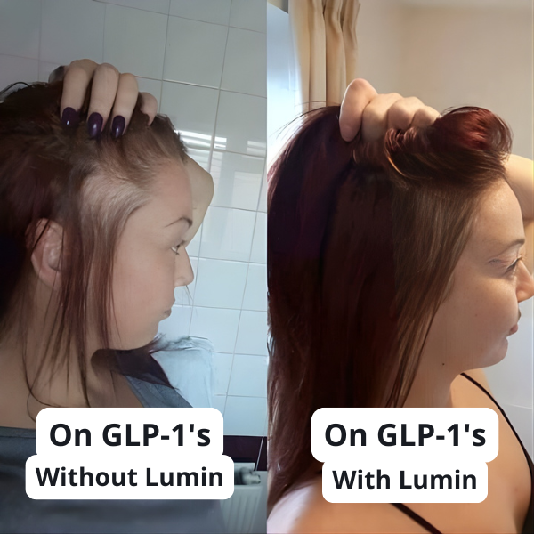 GLP Root Revive