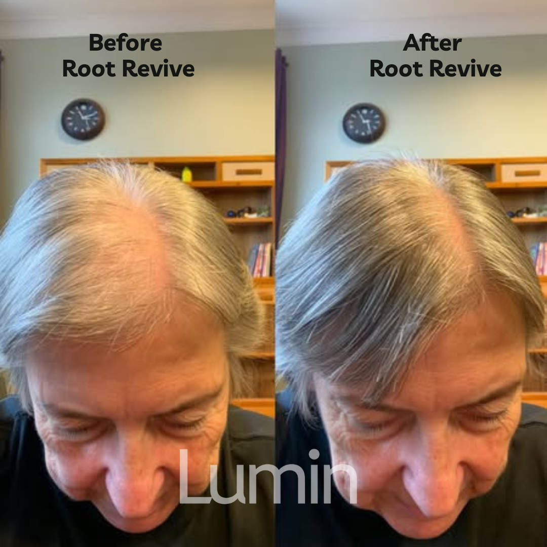 Root Revive
