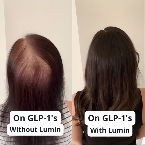 GLP Root Revive