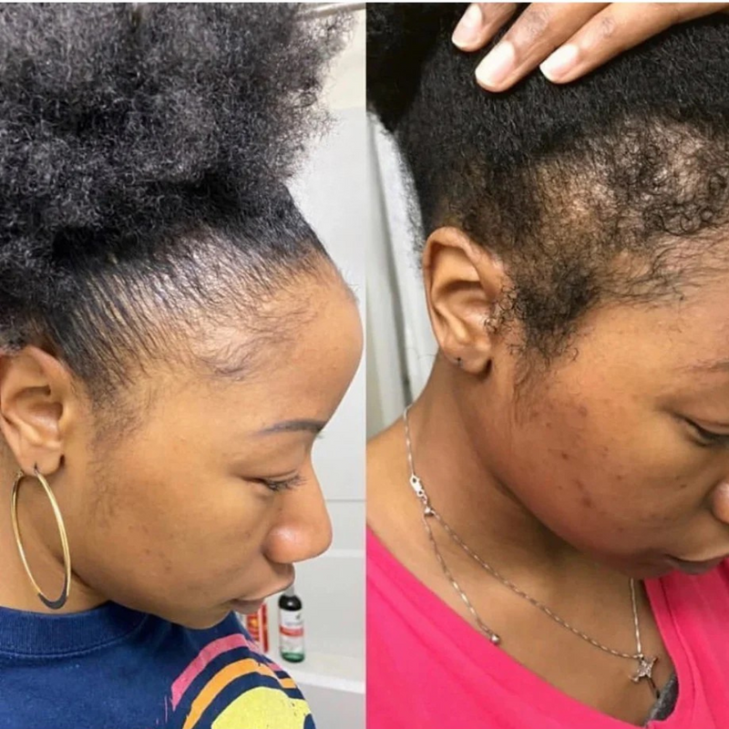 Baby took my edges with him when he came out - Maya K.