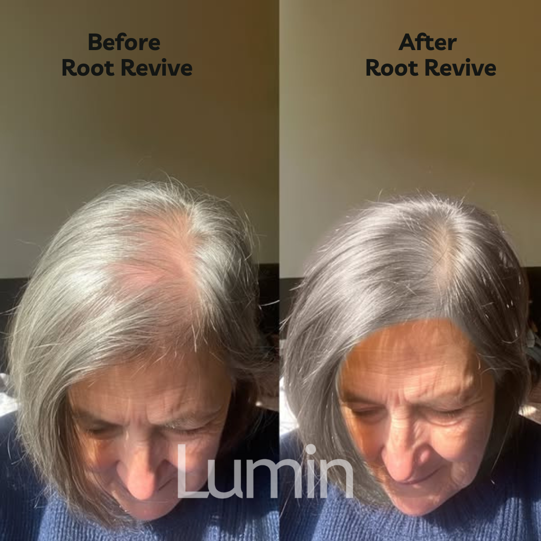 Root Revive