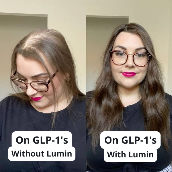 GLP Root Revive