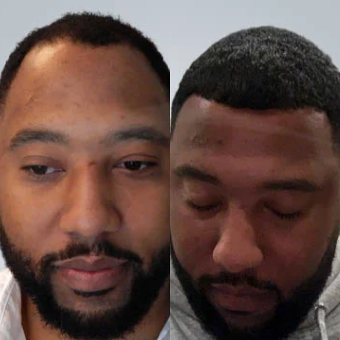 Started getting compliments again - Marcus J.