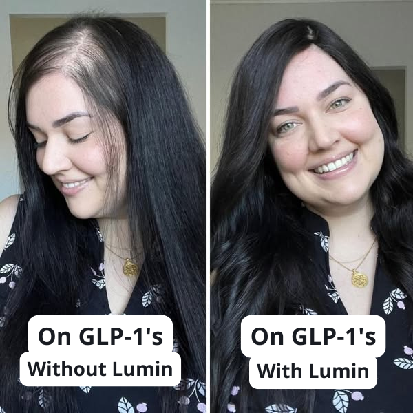 GLP Root Revive