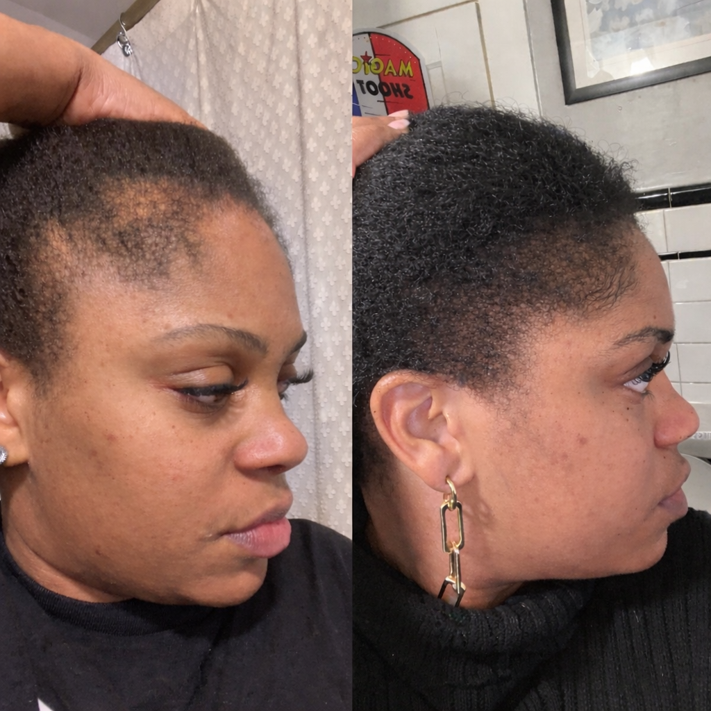 Hormone Hair Revive: 2+1 FREE