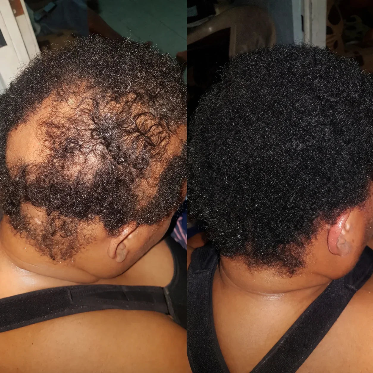 Hormone Hair Revive: 2+1 FREE