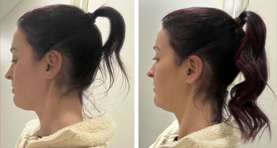 Thicker, fuller hair